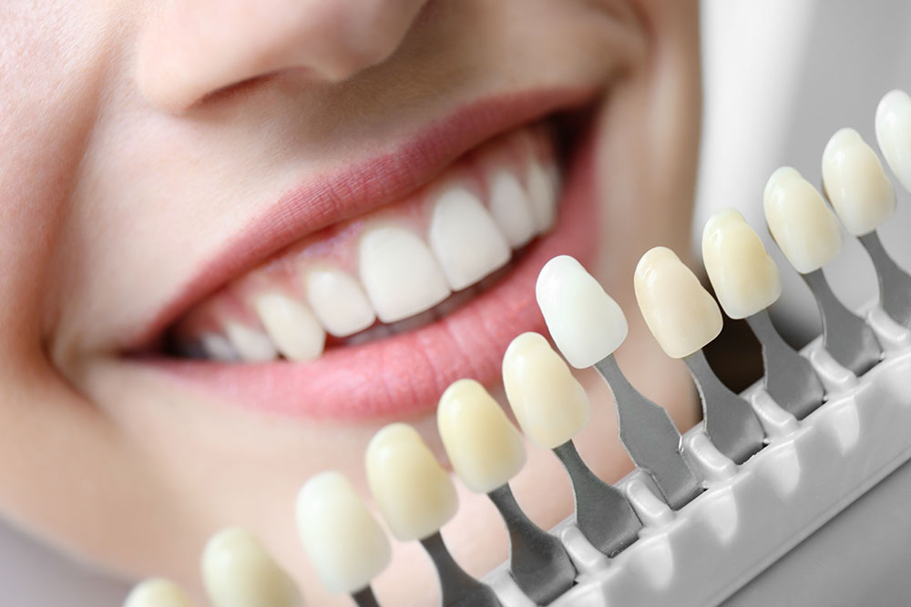 Young woman choosing color of teeth at dentist, closeup