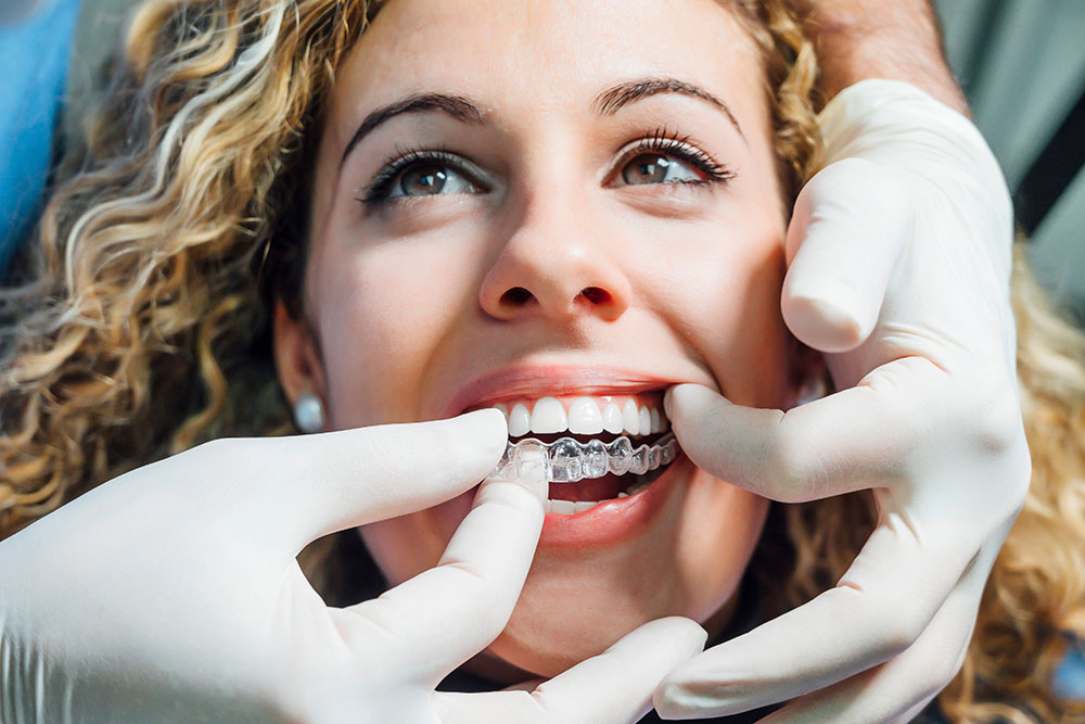 Doctor putting a clear dental aligner to the patient woman